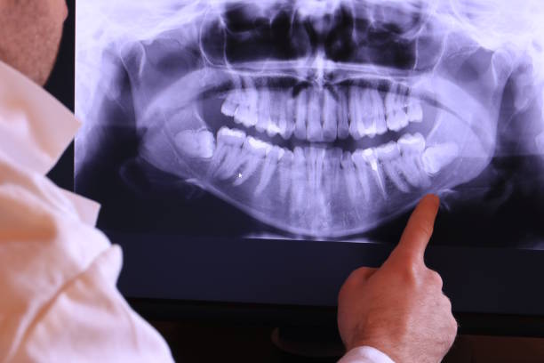 Best Emergency Root Canal Therapy in Maryland City, MD